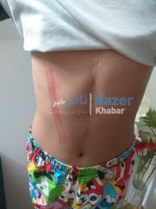 چاه فاضلاب