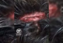 دانش‌آموز مجروح لوشانی با فرق سر شکافته در پی ضربه صندلی آهنی همکلاسی در کلاس درس دبیرستان ولیعصر